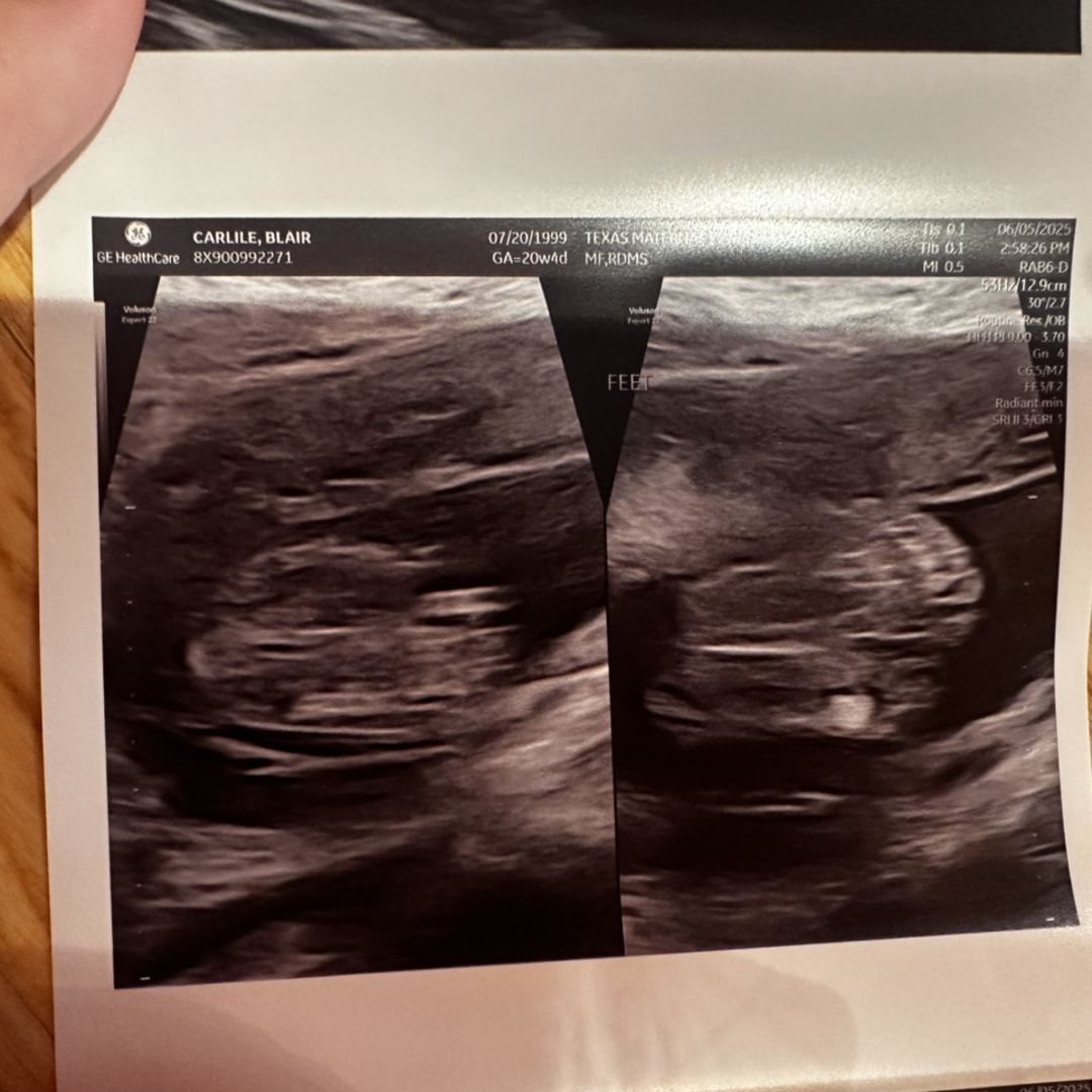 Photo shared by Blair for their Babylist baby registry.