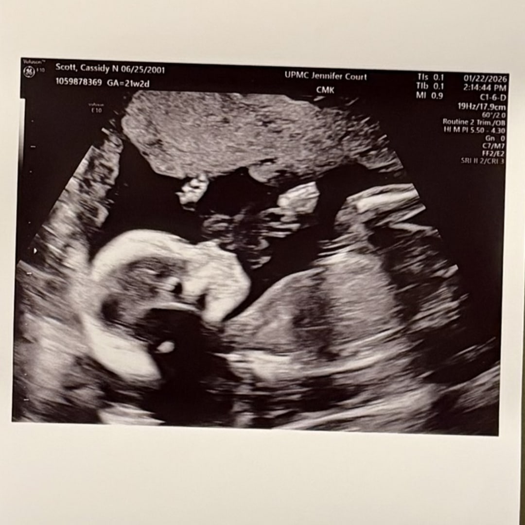 Photo shared by Cassidy for their Babylist baby registry.