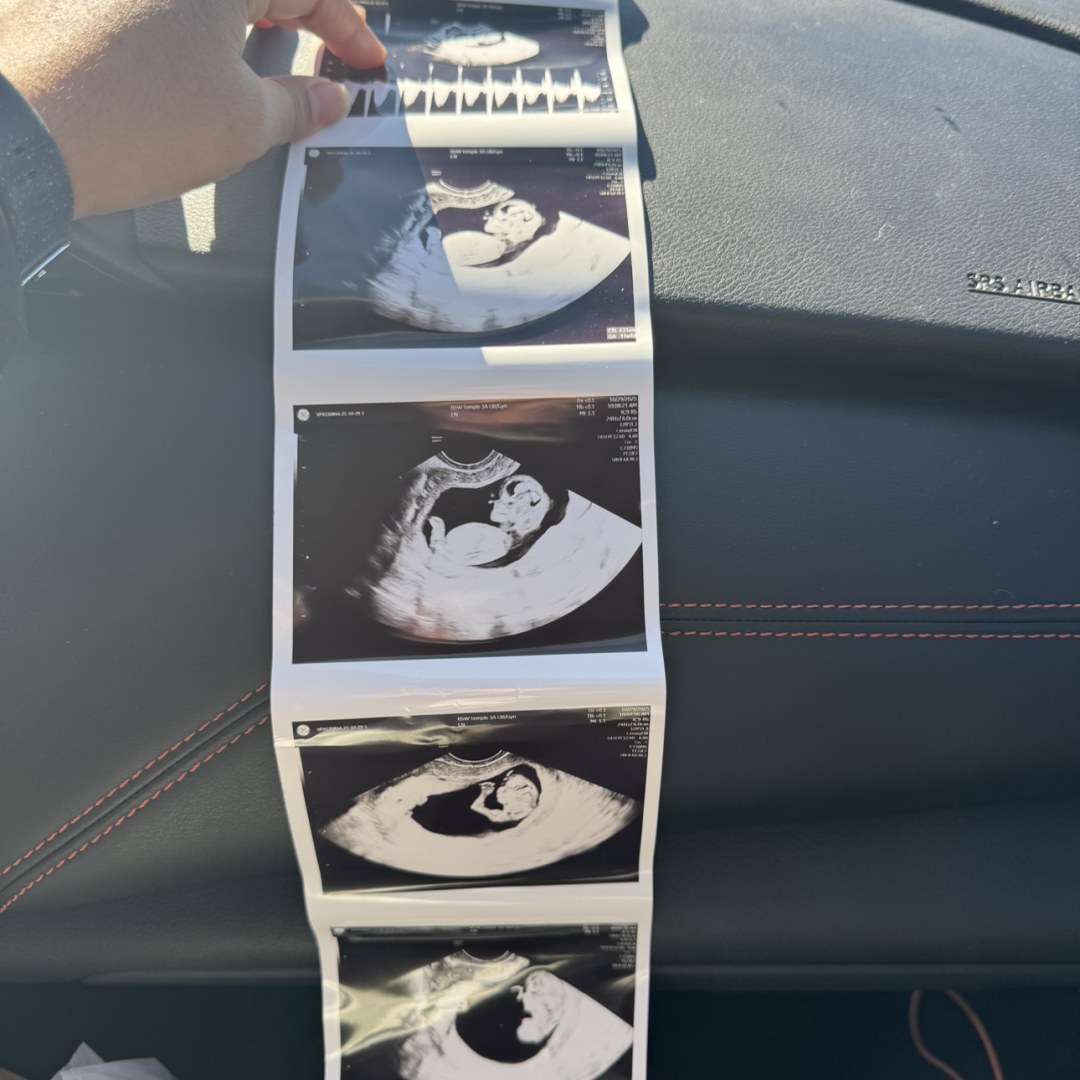 Photo shared by Camryn for their Babylist baby registry.