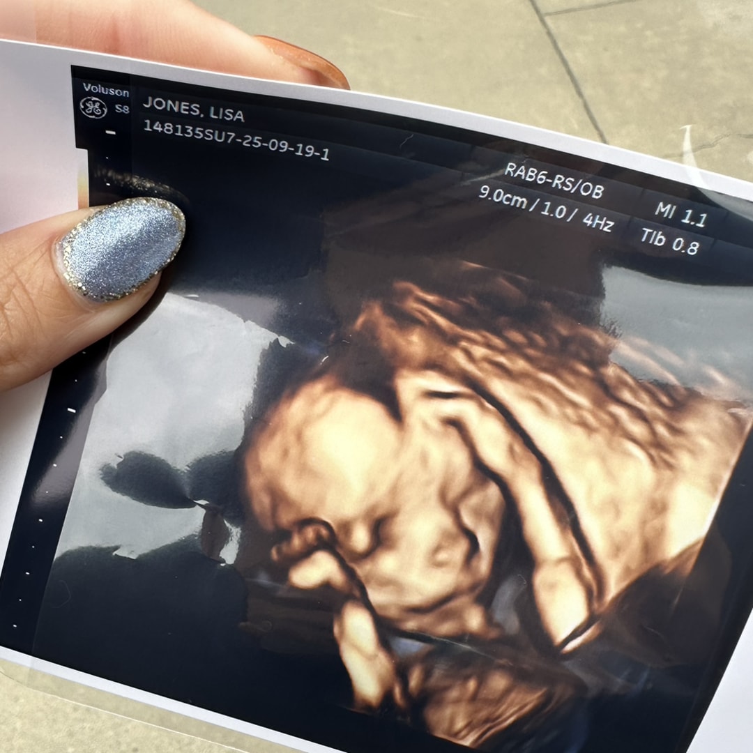 Photo shared by Lisa for their Babylist baby registry.