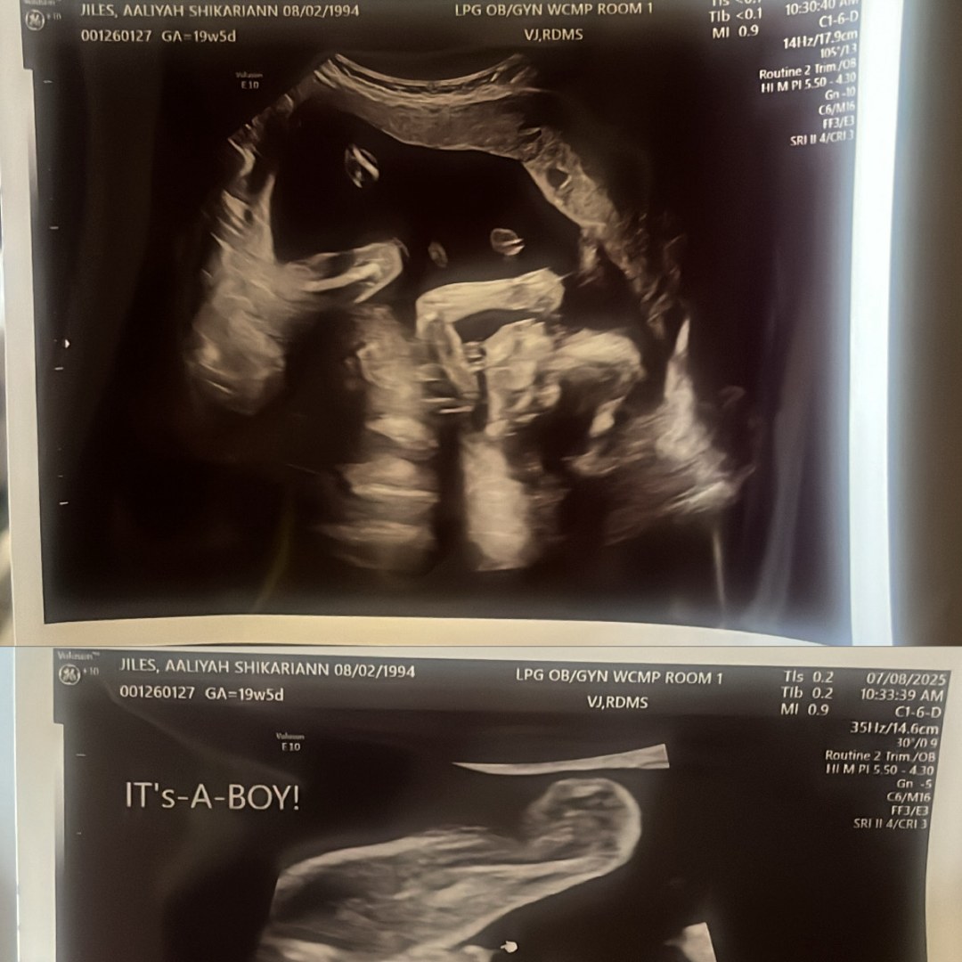 Photo shared by Aaliyah for their Babylist baby registry.