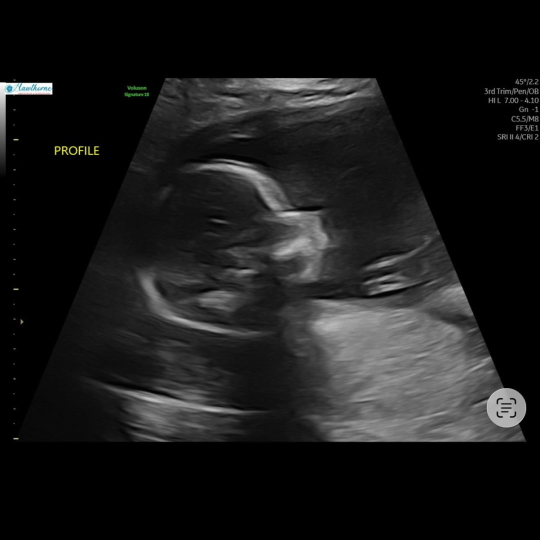 Photo shared by Casey for their Babylist baby registry.