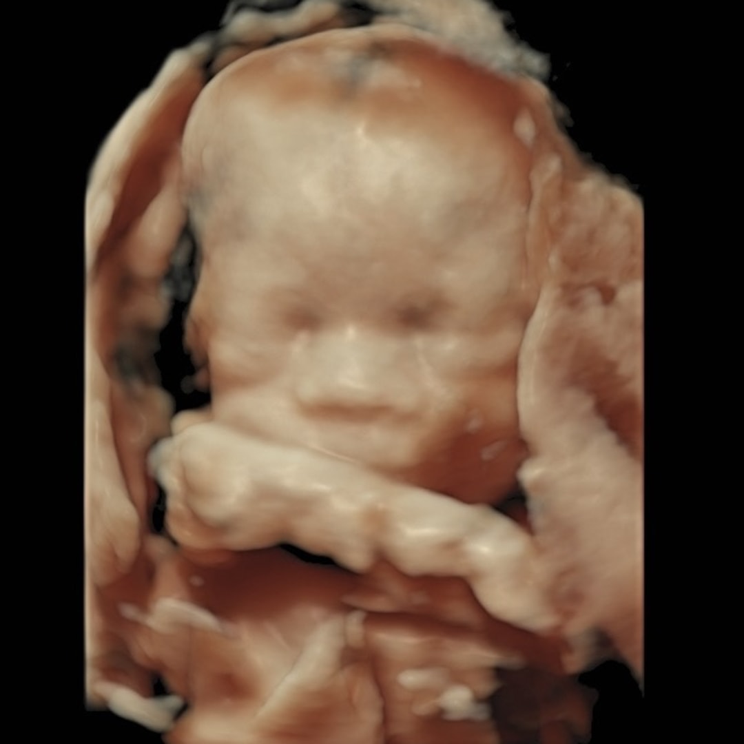 Photo shared by Cassandra for their Babylist baby registry.