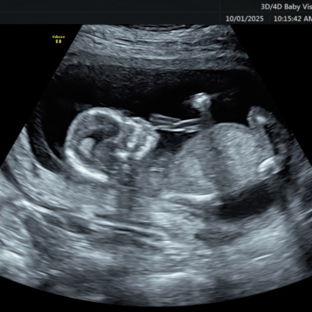 Photo shared by Sarah for their Babylist baby registry.