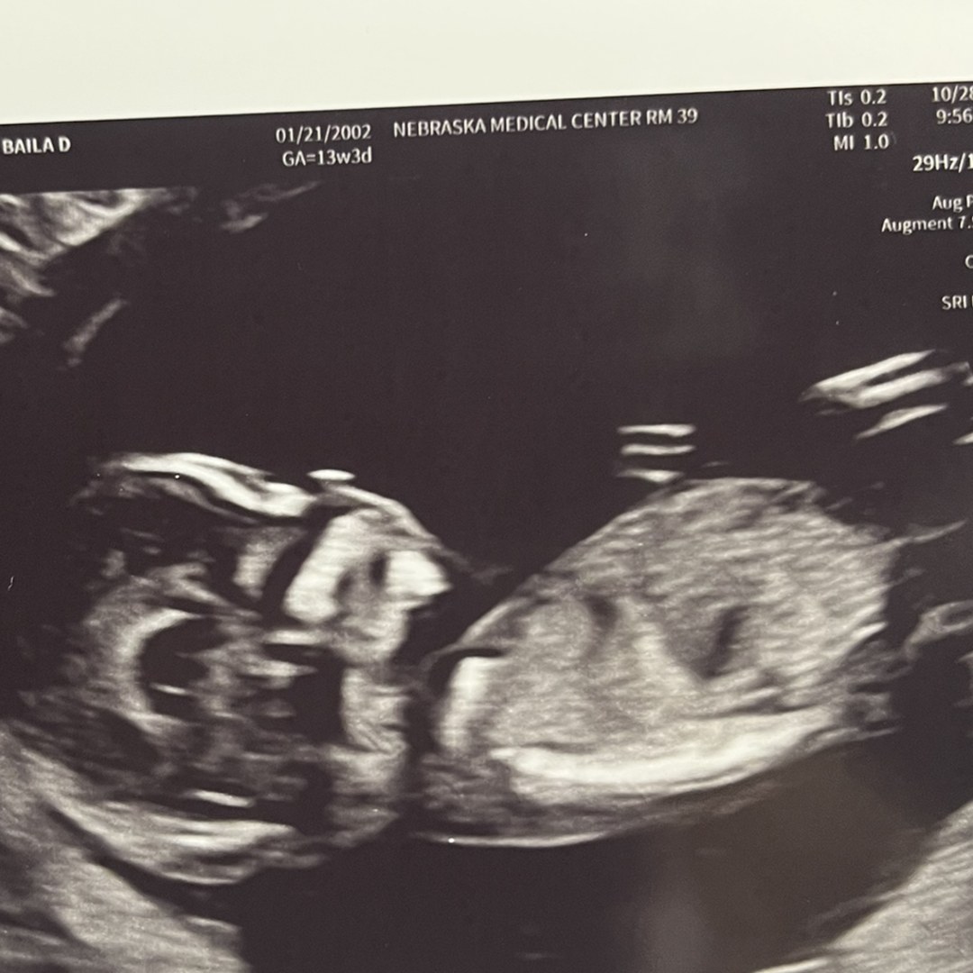 Photo shared by Baila for their Babylist baby registry.