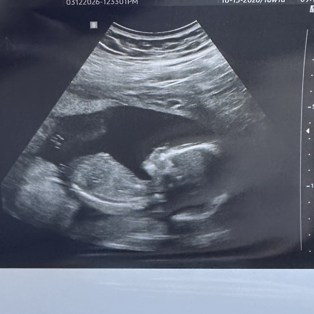 Photo shared by Amber for their Babylist baby registry.