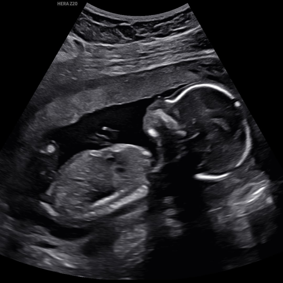 Photo shared by Amarah for their Babylist baby registry.