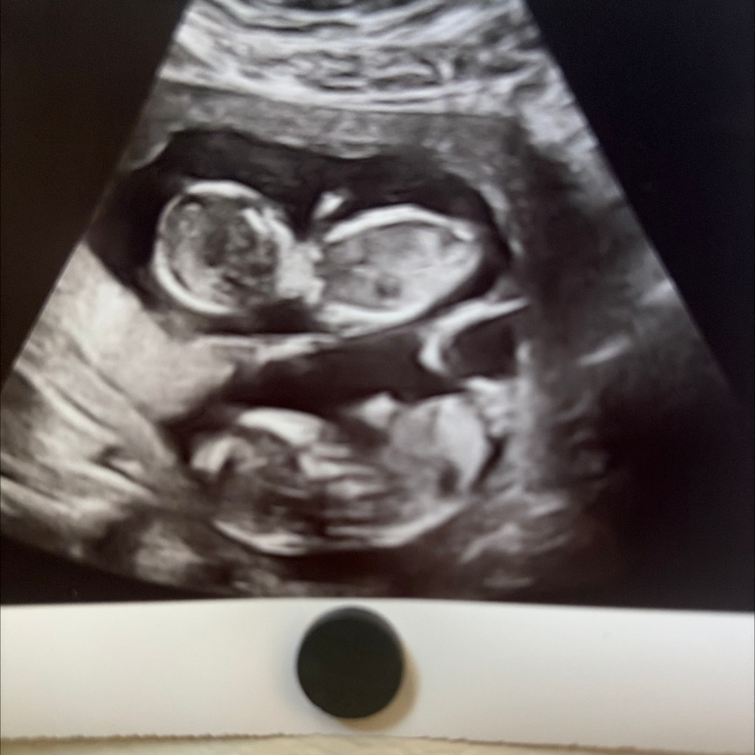 Photo shared by Sunny for their Babylist baby registry.