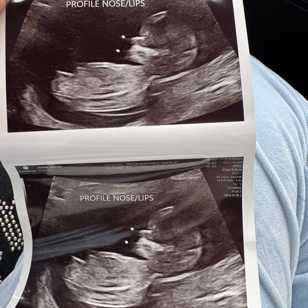 Photo shared by Alexa for their Babylist baby registry.
