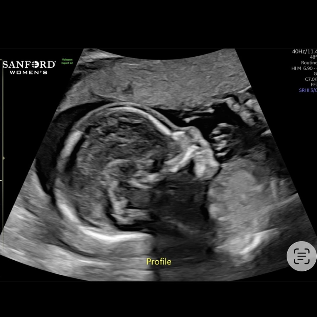 Photo shared by Chelsea for their Babylist baby registry.