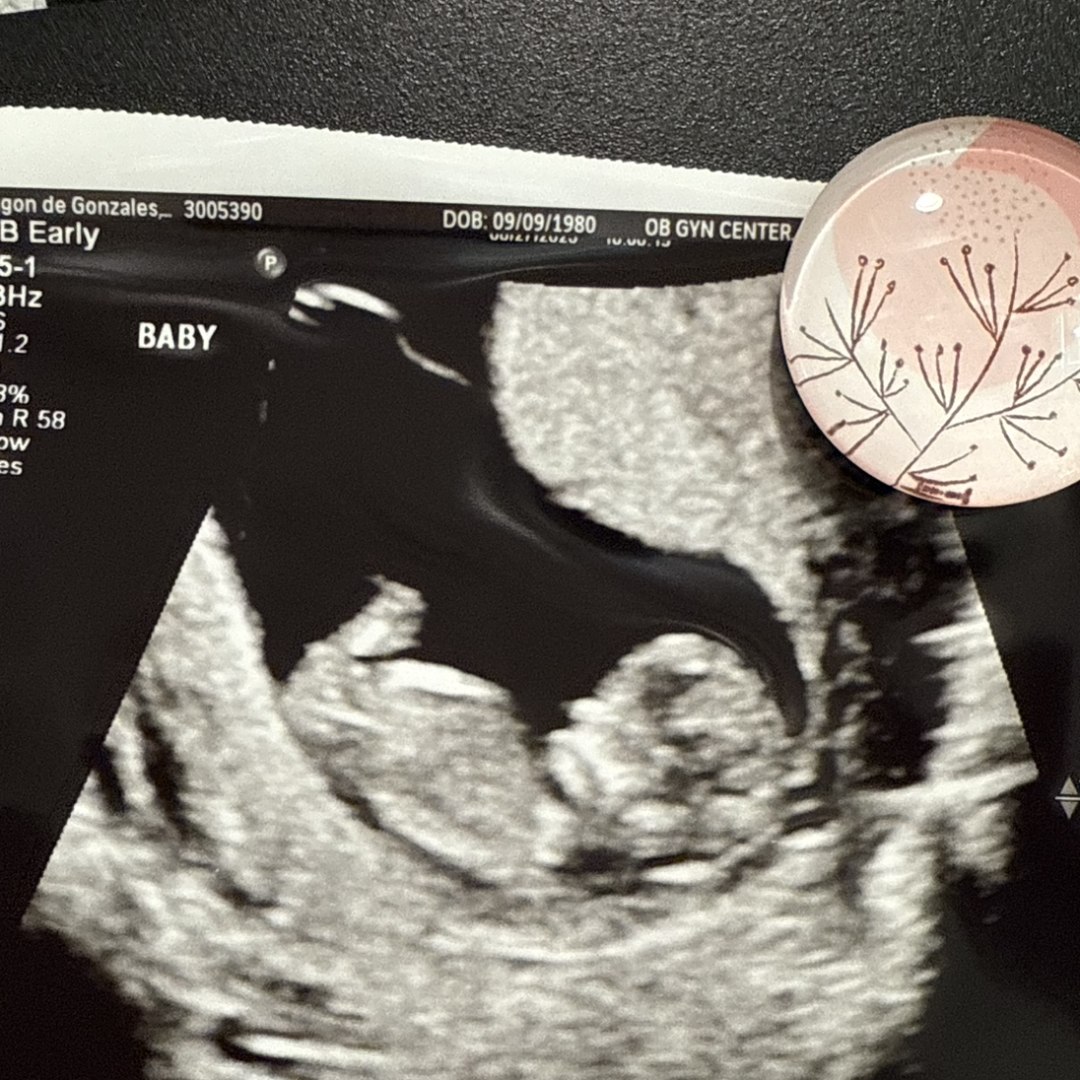 Photo shared by Maria for their Babylist baby registry.