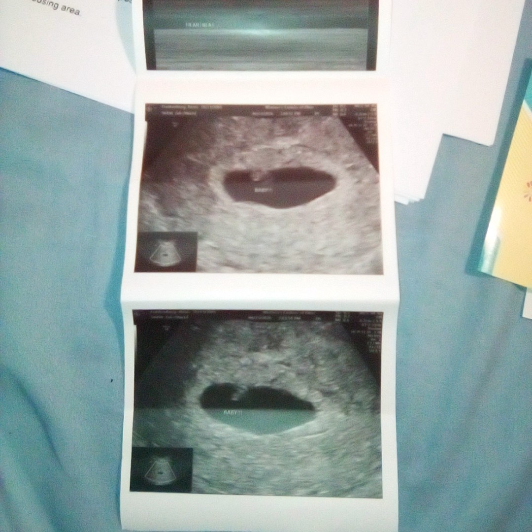 Photo shared by Alexis for their Babylist baby registry.