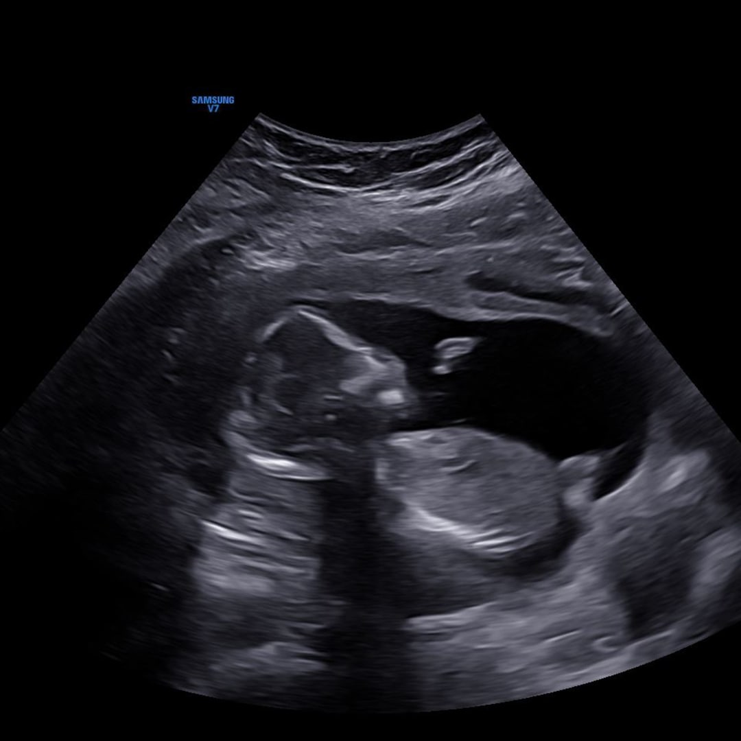 Photo shared by Anna for their Babylist baby registry.