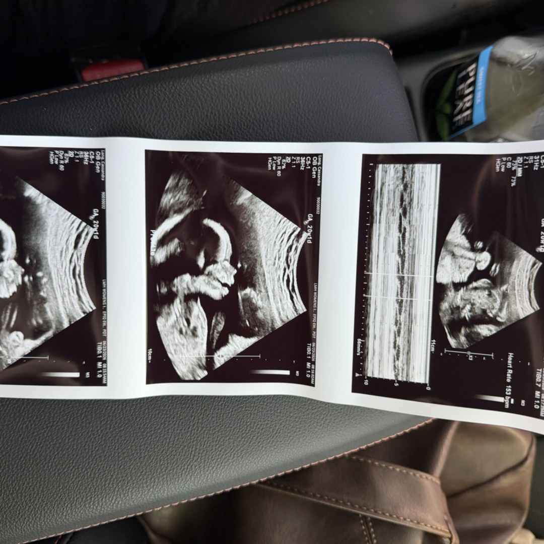 Photo shared by Cassie for their Babylist baby registry.