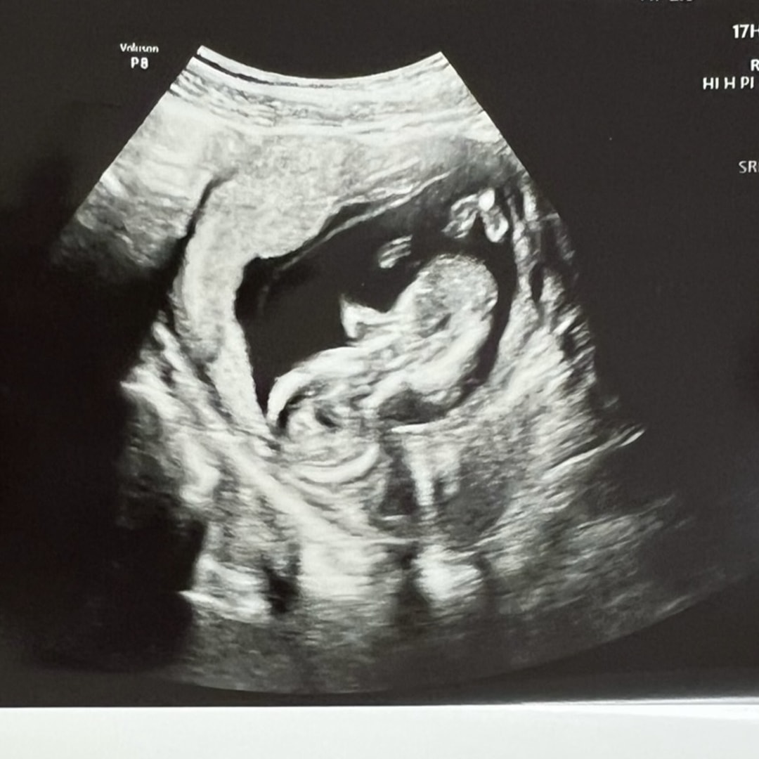 Photo shared by Kameryn for their Babylist baby registry.