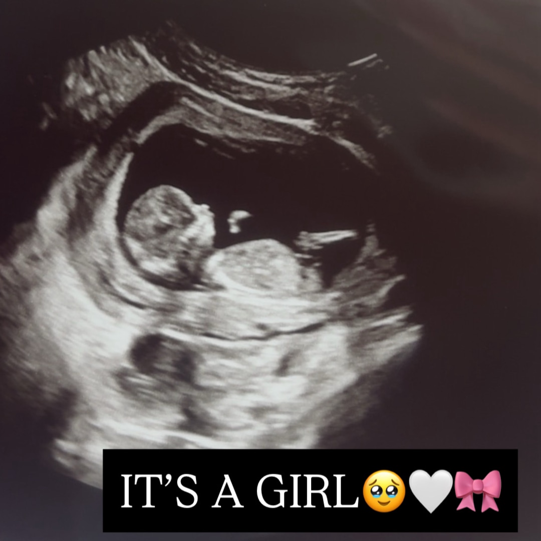 Photo shared by Emma for their Babylist baby registry.