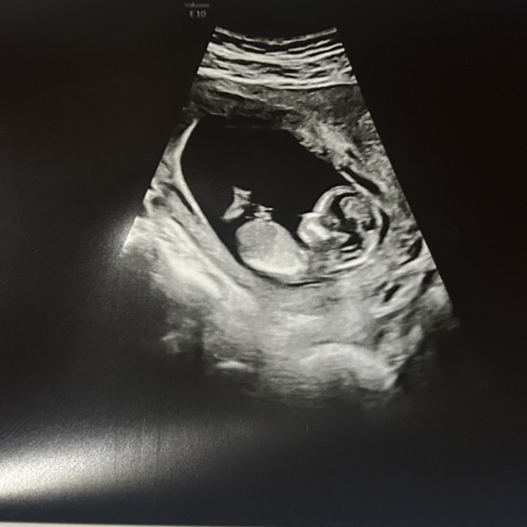 Photo shared by Jordan for their Babylist baby registry.