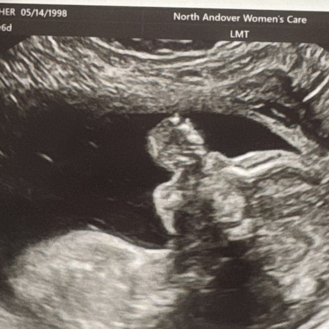 Photo shared by Heather for their Babylist baby registry.