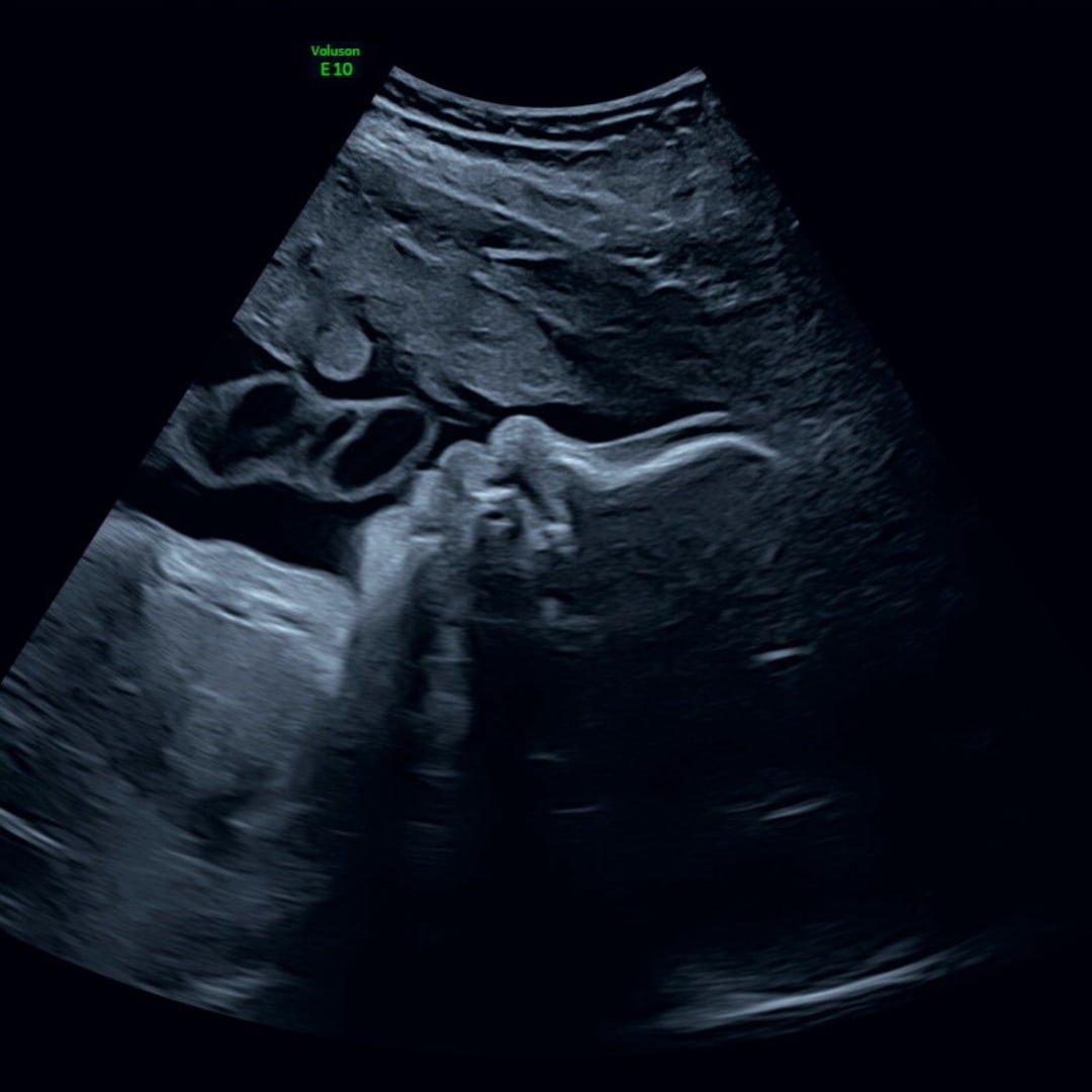 Photo shared by Sarah for their Babylist baby registry.