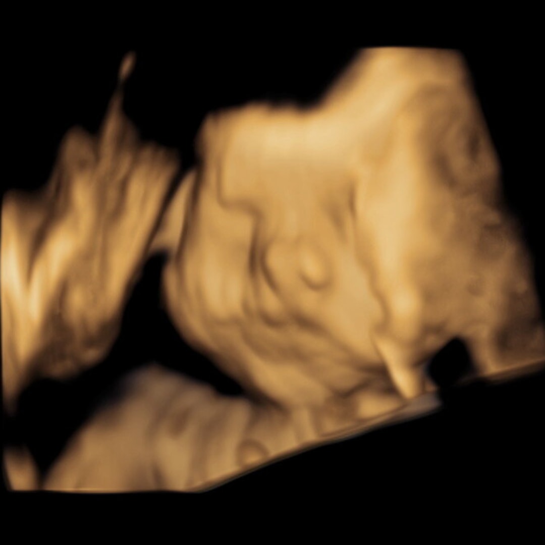 Photo shared by Lillie for their Babylist baby registry.