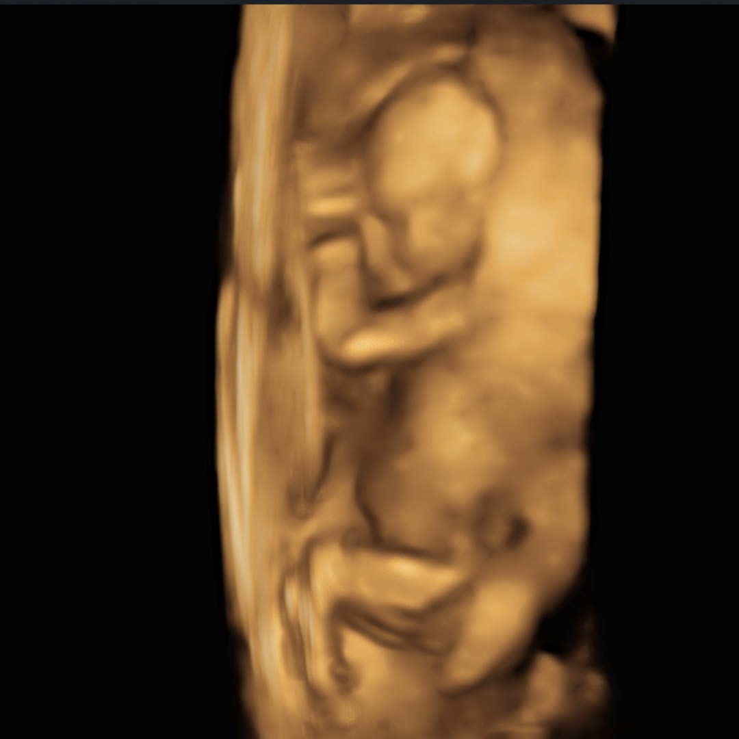 Photo shared by Liz for their Babylist baby registry.