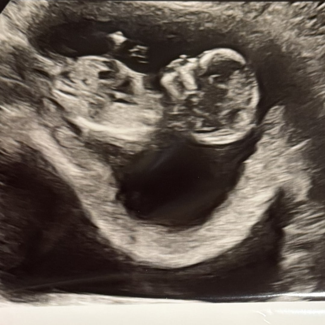Photo shared by Holly for their Babylist baby registry.