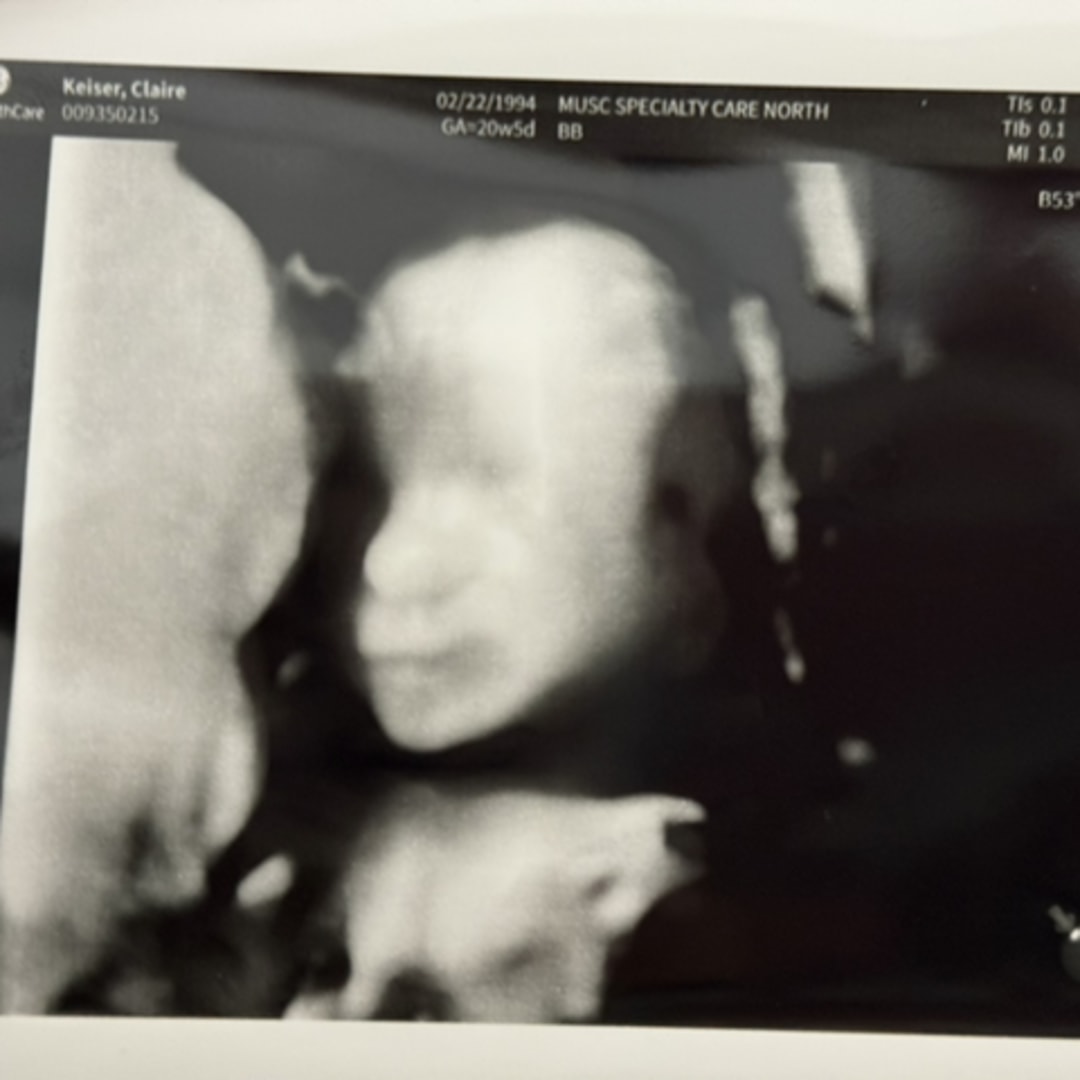 Photo shared by Claire for their Babylist baby registry.
