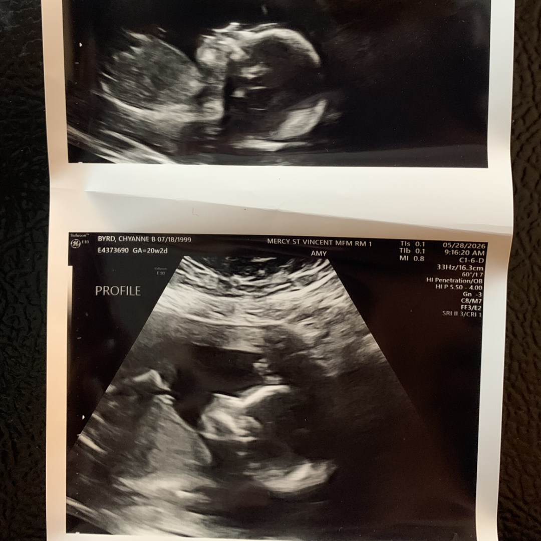 Photo shared by Chyanne for their Babylist baby registry.