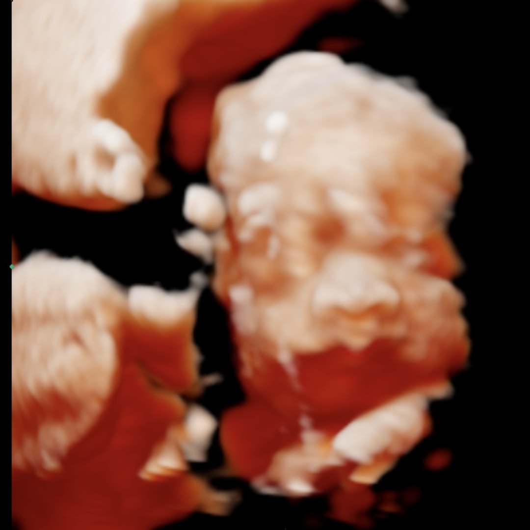 Photo shared by Athziri for their Babylist baby registry.