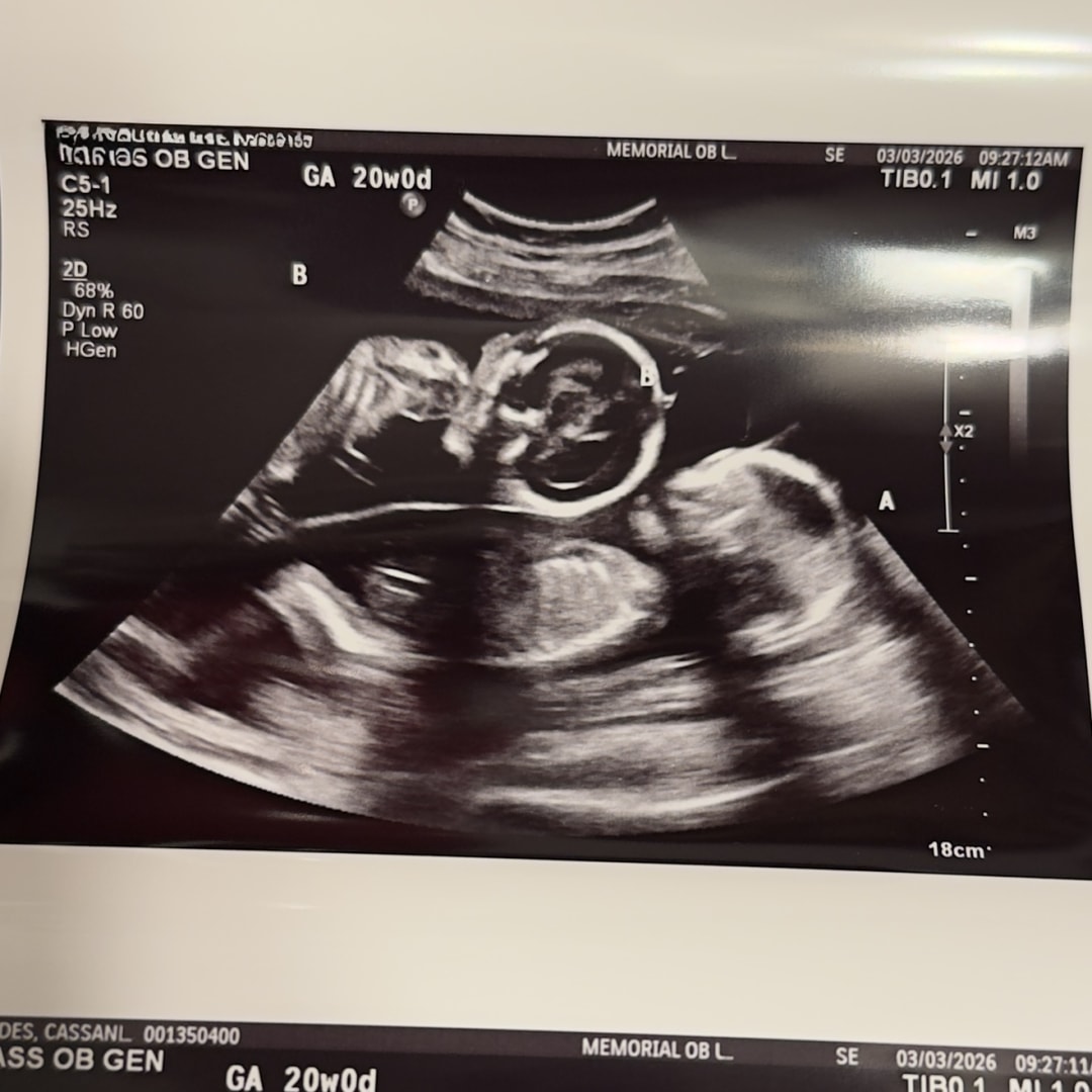 Photo shared by Cassandra for their Babylist baby registry.