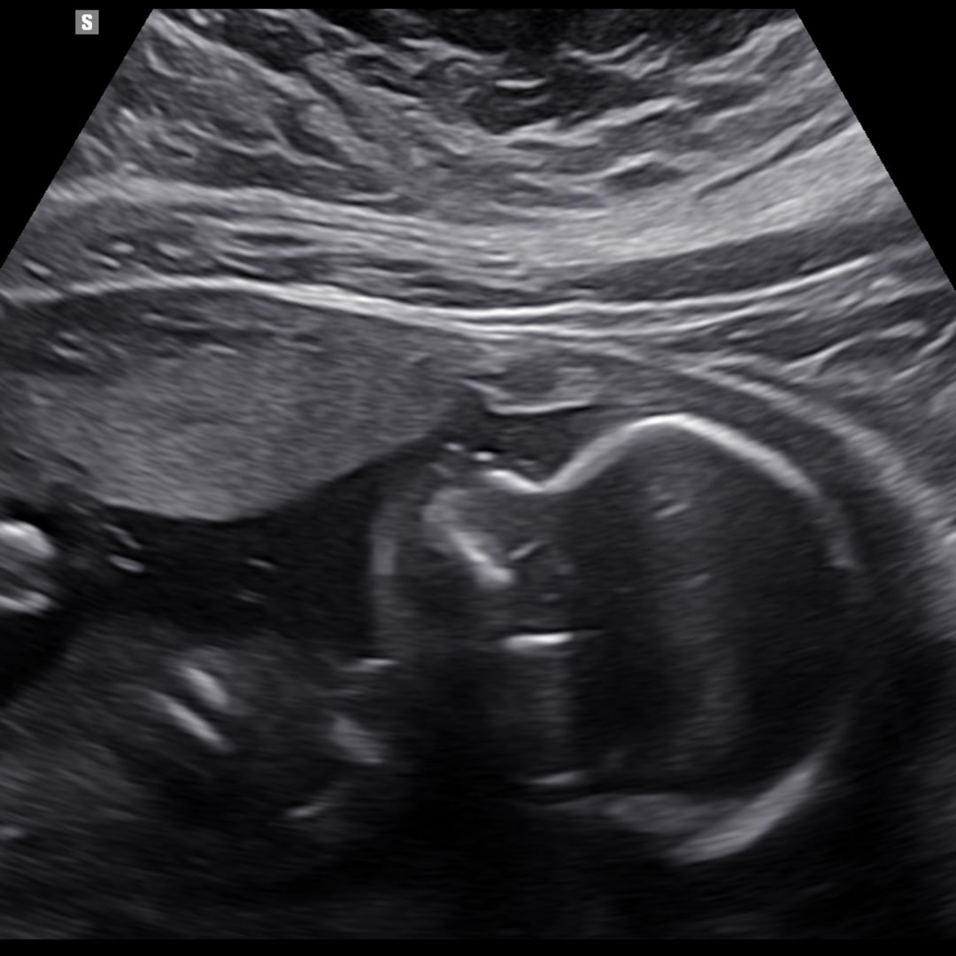 Photo shared by Alyssa for their Babylist baby registry.