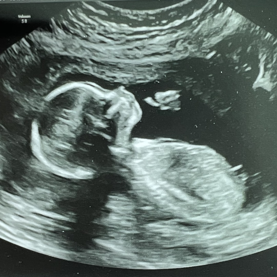 Photo shared by Zitlaly for their Babylist baby registry.