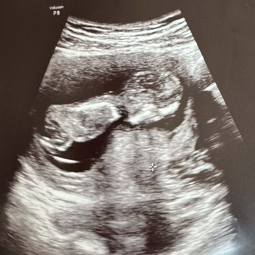 Photo shared by Hannah for their Babylist baby registry.