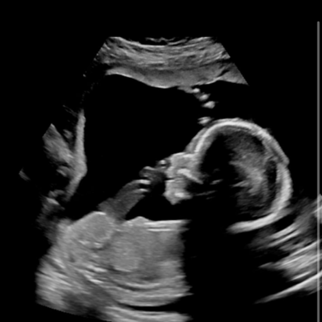 Photo shared by Sophia for their Babylist baby registry.