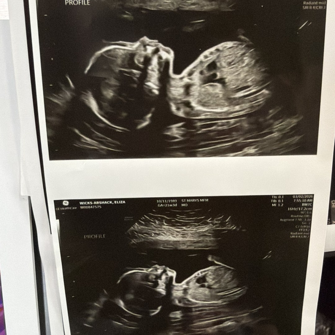 Photo shared by Eliza for their Babylist baby registry.