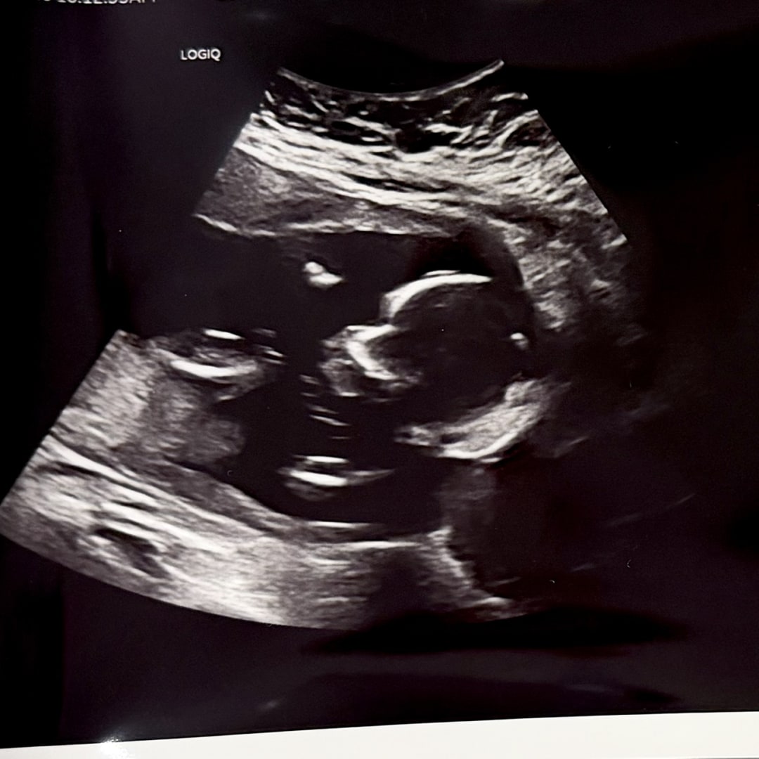 Photo shared by Dede for their Babylist baby registry.