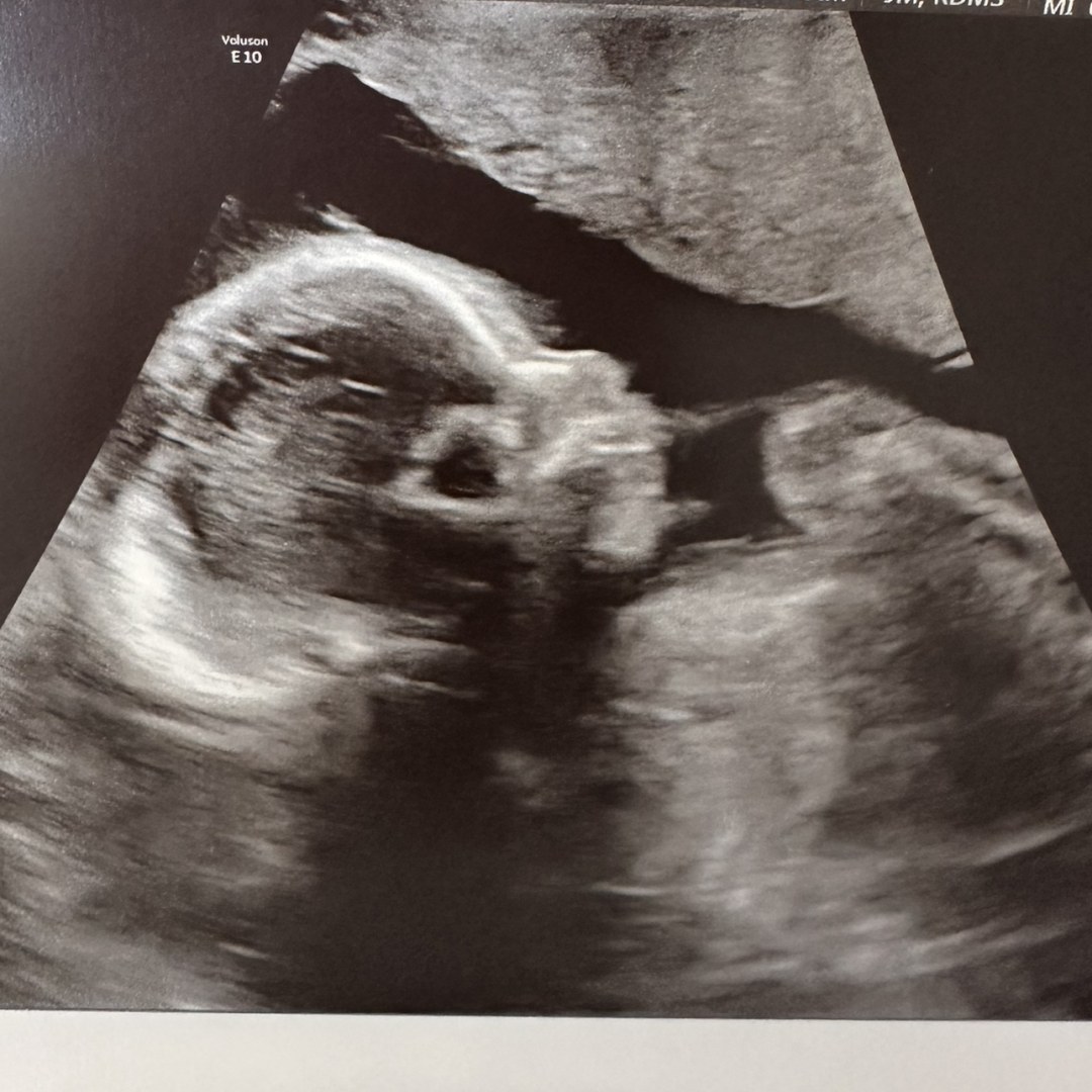 Photo shared by Sabina for their Babylist baby registry.