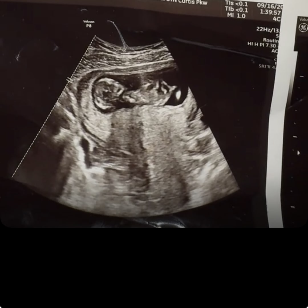 Photo shared by Breonna for their Babylist baby registry.