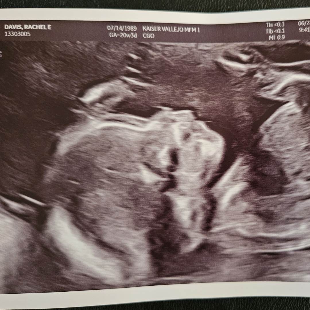 Photo shared by Rachel for their Babylist baby registry.