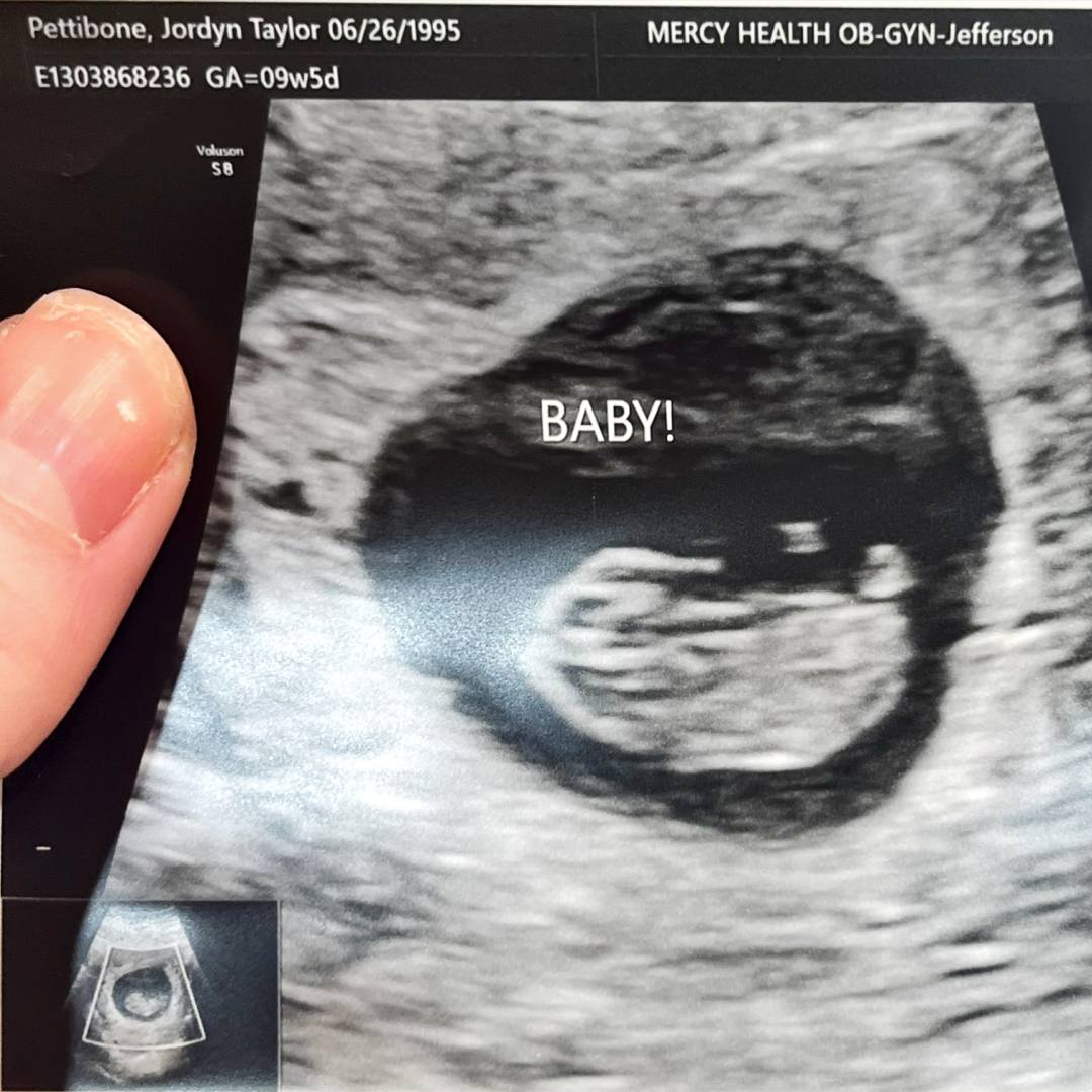 Photo shared by Jordyn for their Babylist baby registry.