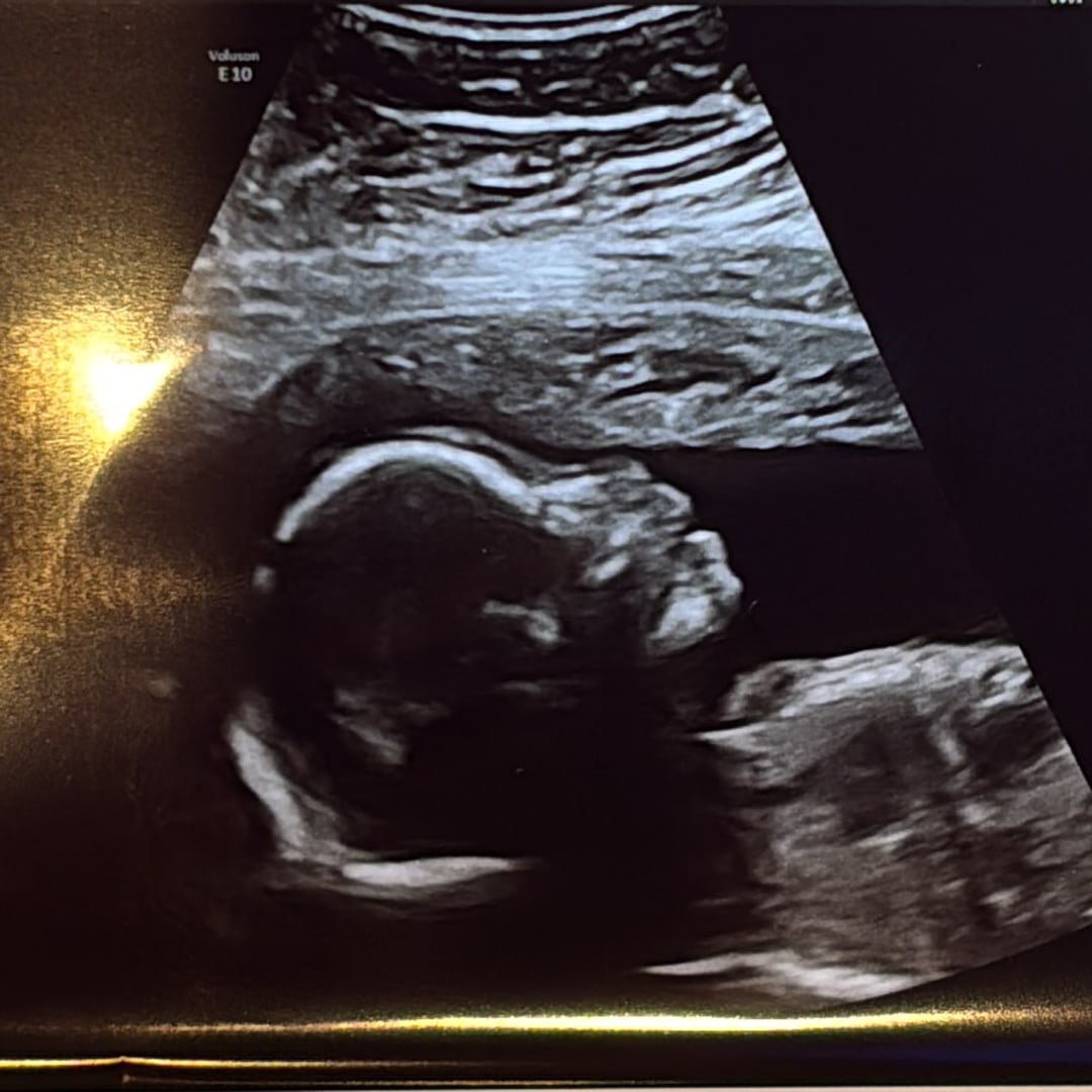 Photo shared by Juan for their Babylist baby registry.