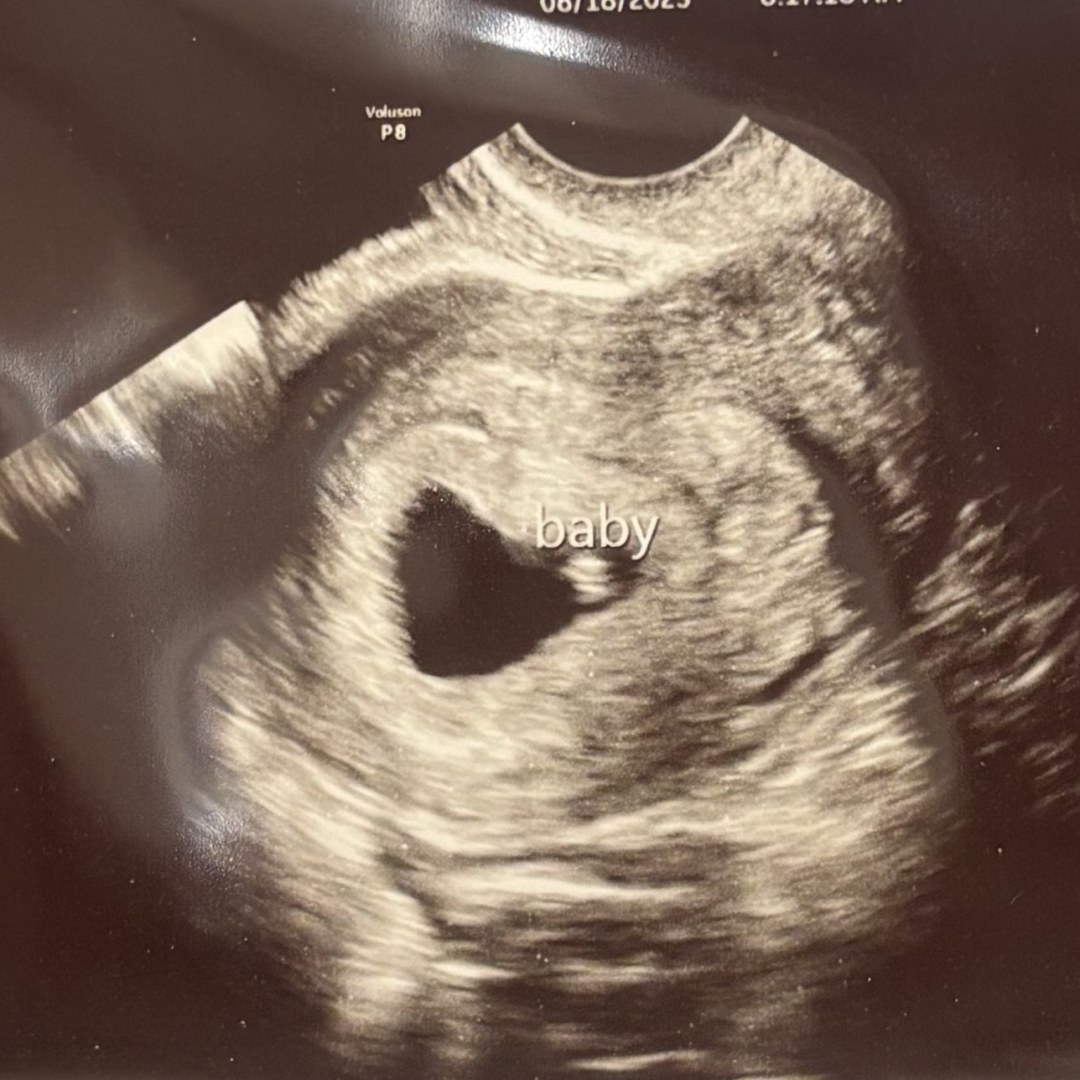 Photo shared by Makenna for their Babylist baby registry.