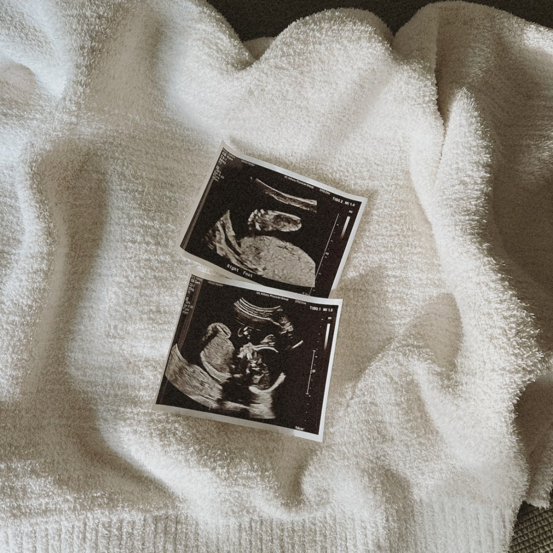 Photo shared by Sarah for their Babylist baby registry.