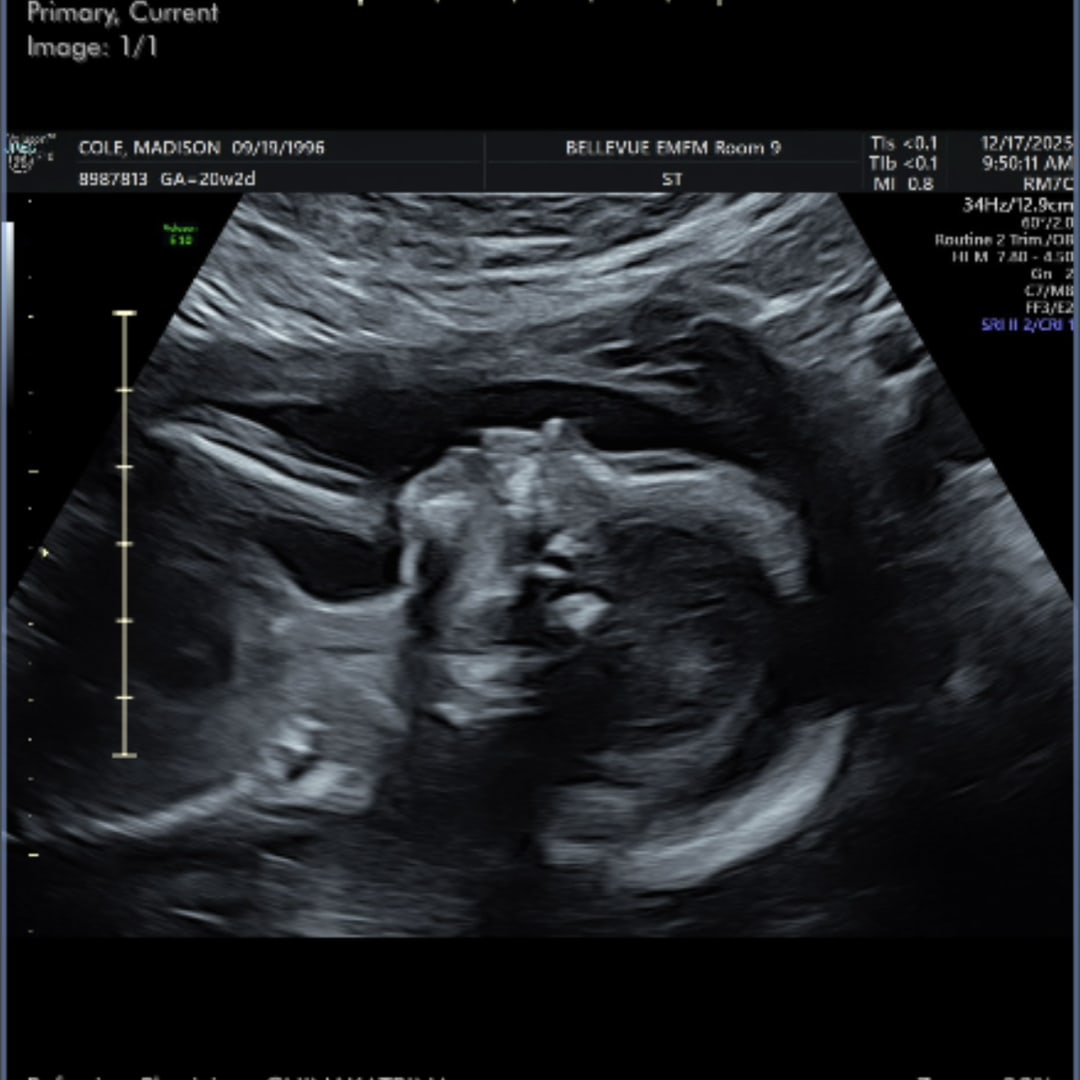 Photo shared by Madison for their Babylist baby registry.