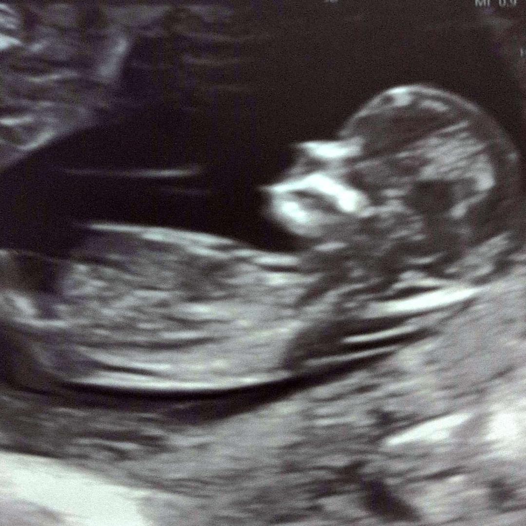 Photo shared by Alexandra for their Babylist baby registry.