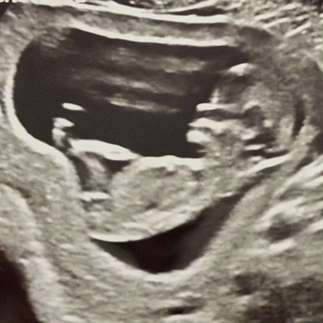 Photo shared by Leigh for their Babylist baby registry.