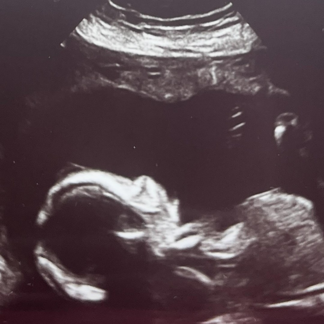 Photo shared by Sandy for their Babylist baby registry.