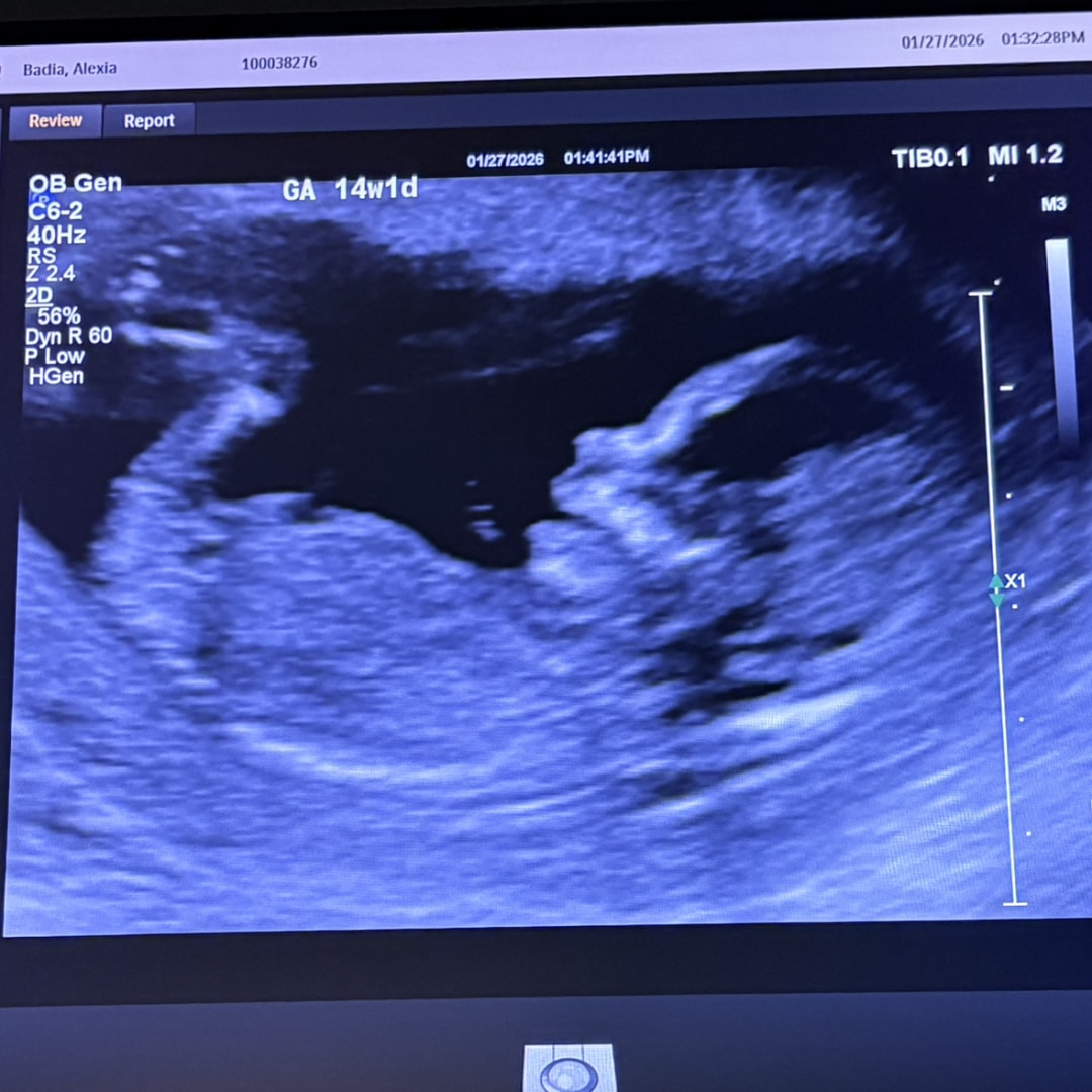 Photo shared by Alexa for their Babylist baby registry.