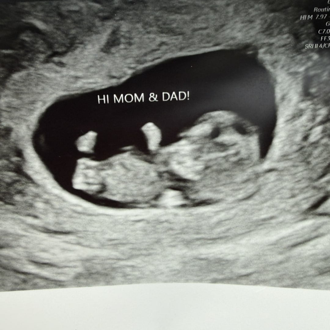 Photo shared by Gabrielle for their Babylist baby registry.