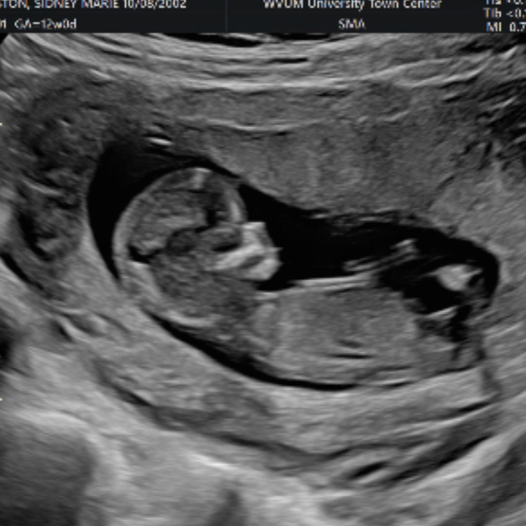 Photo shared by Sidney for their Babylist baby registry.